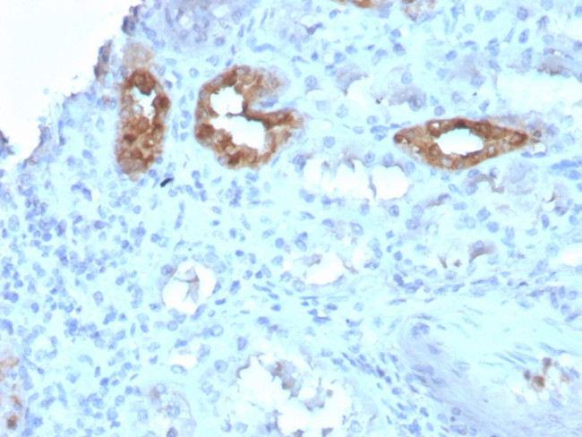 Calbindin 1 (CALB1) Antibody in Immunohistochemistry (Paraffin) (IHC (P))