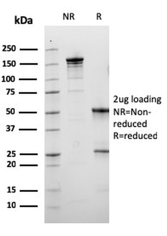 Calbindin 1 (CALB1) Antibody in SDS-PAGE (SDS-PAGE)