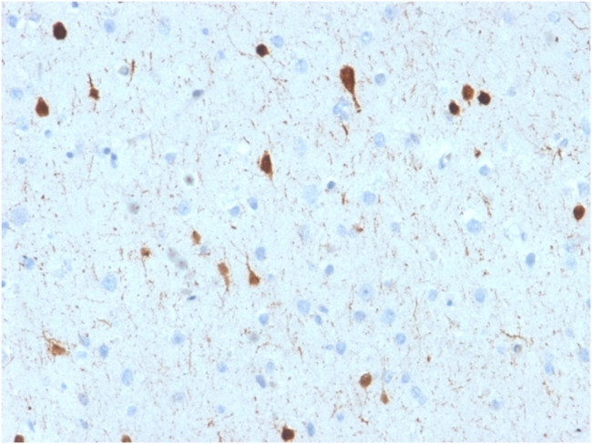 Calretinin/Calbindin 2 Antibody in Immunohistochemistry (Paraffin) (IHC (P))