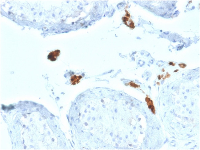 Calretinin/Calbindin 2 Antibody in Immunohistochemistry (Paraffin) (IHC (P))