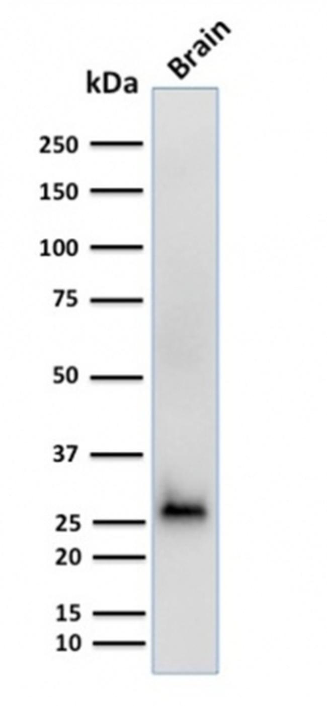 Calretinin/Calbindin 2 Antibody in Western Blot (WB)