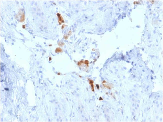 Calretinin/Calbindin 2 (Mesothelioma Marker) Antibody in Immunohistochemistry (Paraffin) (IHC (P))