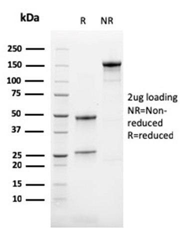 Calretinin/Calbindin 2 (Mesothelioma Marker) Antibody in SDS-PAGE (SDS-PAGE)