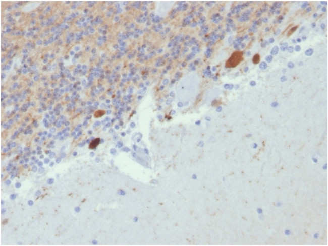 Calretinin/Calbindin 2 (Mesothelioma Marker) Antibody in Immunohistochemistry (Paraffin) (IHC (P))