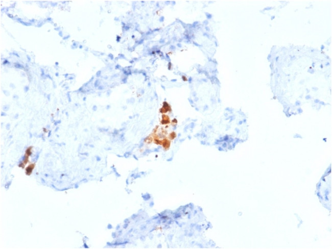 Calretinin/Calbindin 2 (Mesothelioma Marker) Antibody in Immunohistochemistry (Paraffin) (IHC (P))