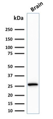 Calretinin/Calbindin 2 (Mesothelioma Marker) Antibody in Western Blot (WB)