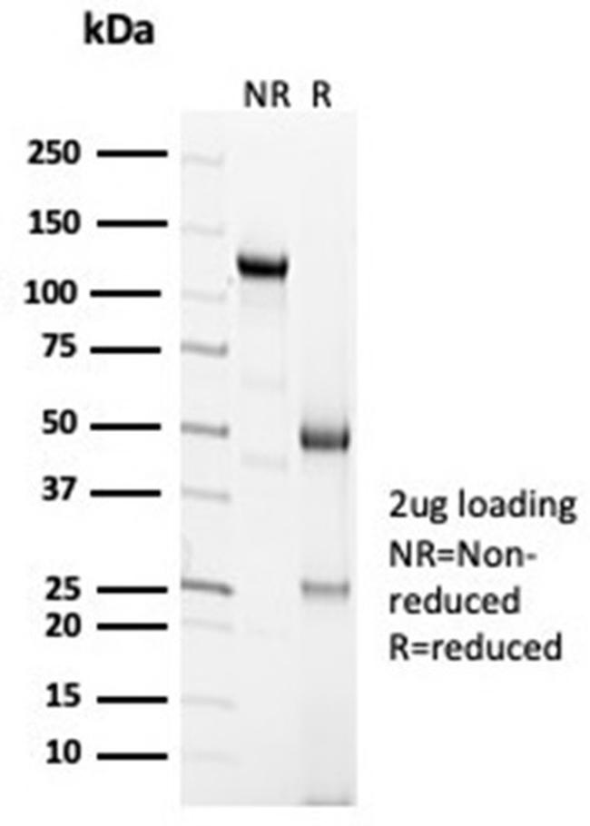 Calretinin/Calbindin 2 (Mesothelioma Marker) Antibody in Immunoelectrophoresis (IE)