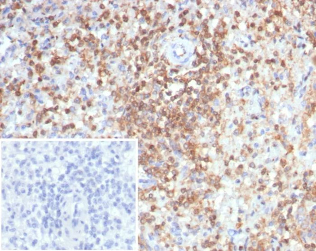 S100G (S100 calcium binding protein G) Antibody in Immunohistochemistry (Paraffin) (IHC (P))