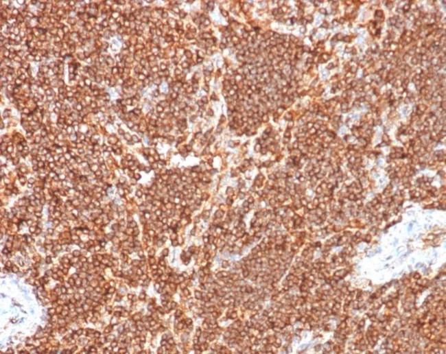 S100G (S100 calcium binding protein G) Antibody in Immunohistochemistry (Paraffin) (IHC (P))