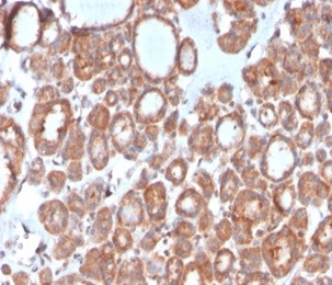 Calcitonin Antibody in Immunohistochemistry (Paraffin) (IHC (P))