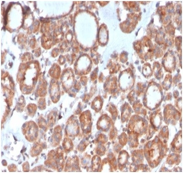 Calcitonin Antibody in Immunohistochemistry (Paraffin) (IHC (P))