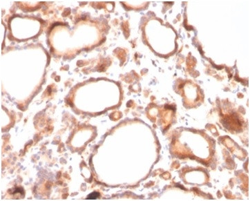 Calcitonin Antibody in Immunohistochemistry (Paraffin) (IHC (P))