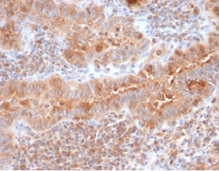 Calcitonin Antibody in Immunohistochemistry (Paraffin) (IHC (P))