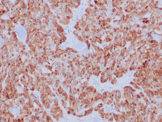 Calcitonin Antibody in Immunohistochemistry (Paraffin) (IHC (P))