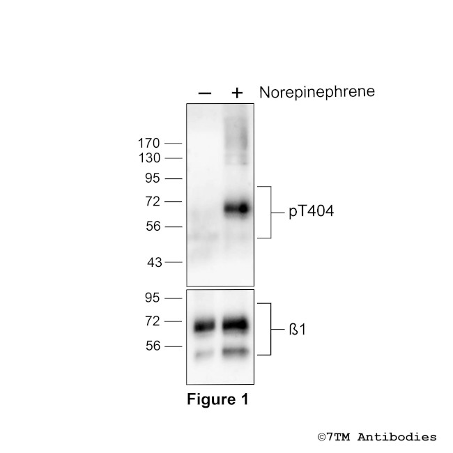 Phospho-beta-1-Adrenoceptor (Thr404) Antibody in Western Blot (WB)