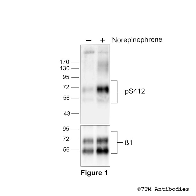 Phospho-beta-1-Adrenoceptor (Ser412) Antibody in Western Blot (WB)