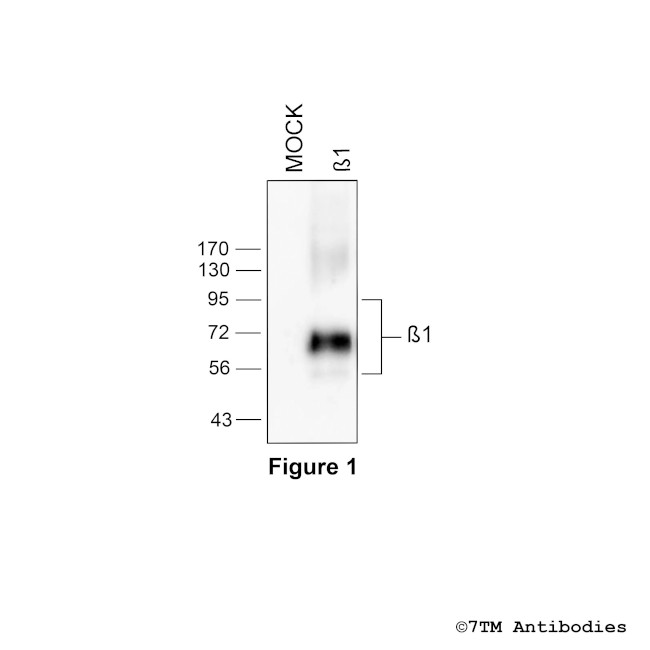 beta-1, beta-1-Adrenoceptor Antibody in Western Blot (WB)