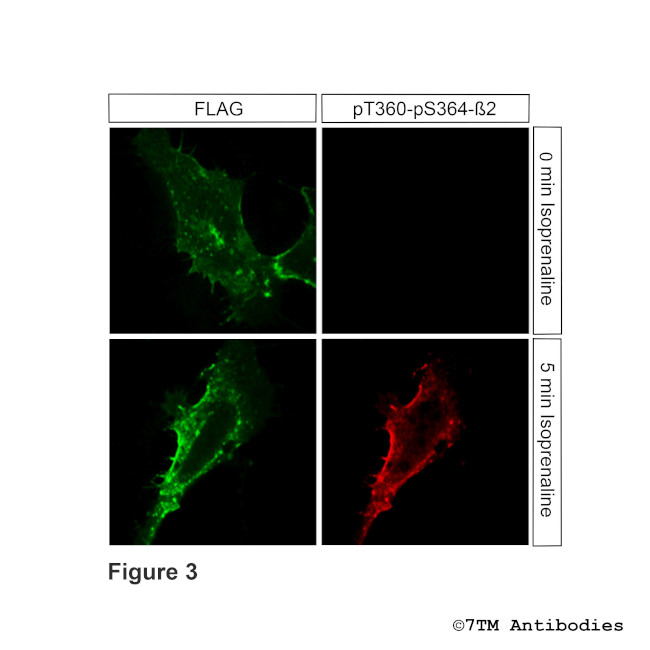 Phospho-beta-2-Adrenoceptor (Thr360, Ser364) Antibody in Immunocytochemistry (ICC/IF)