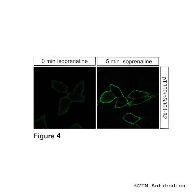 Phospho-beta-2-Adrenoceptor (Thr360, Ser364) Antibody in Immunocytochemistry (ICC/IF)