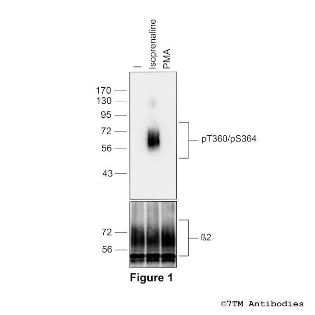 Phospho-beta-2-Adrenoceptor (Thr360, Ser364) Antibody in Western Blot (WB)