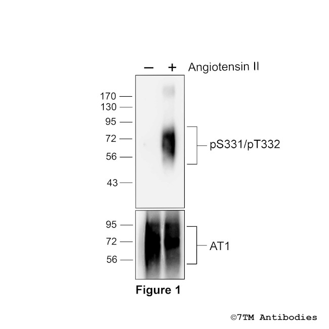 Phospho-Angiotensin Receptor 1 (Ser331, Thr332) Antibody in Western Blot (WB)