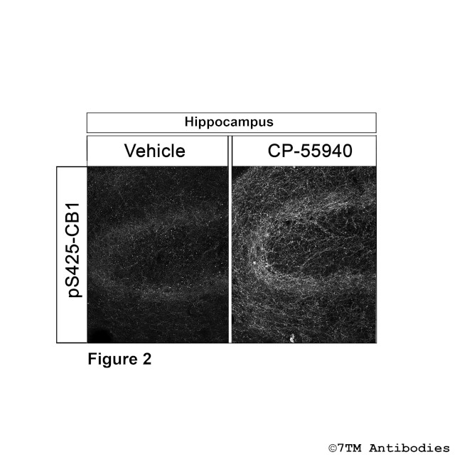 Phospho-Cannabinoid Receptor 1 (Ser425) Antibody in Immunohistochemistry (PFA fixed) (IHC (PFA))