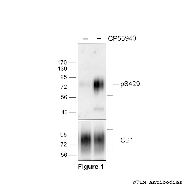 Phospho-Cannabinoid Receptor 1 (Ser429) Antibody in Western Blot (WB)