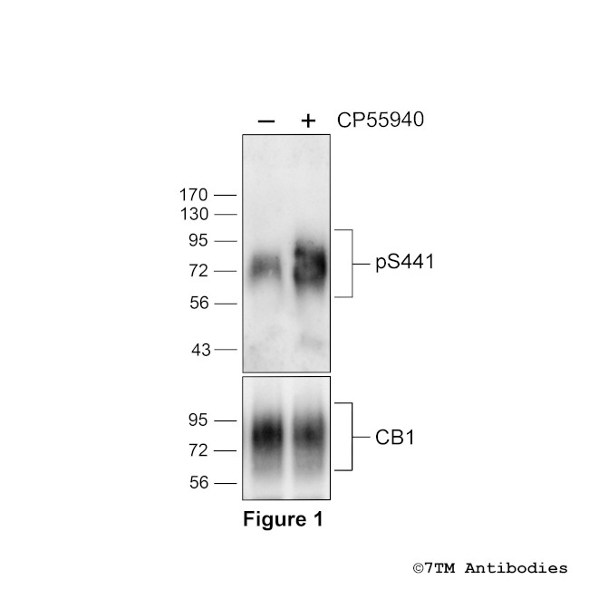 Phospho-Cannabinoid Receptor 1 (Ser441) Antibody in Western Blot (WB)