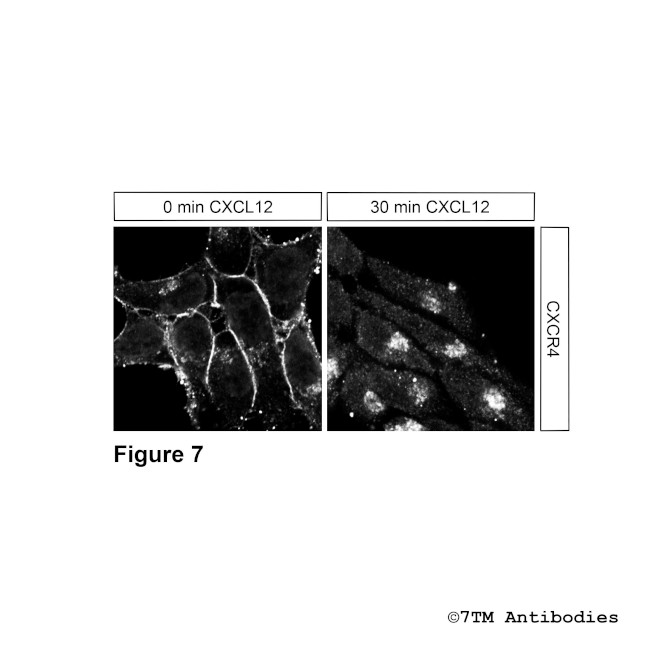 CXCR4, CXC Chemokine Receptor 4 Antibody in Immunocytochemistry (ICC/IF)