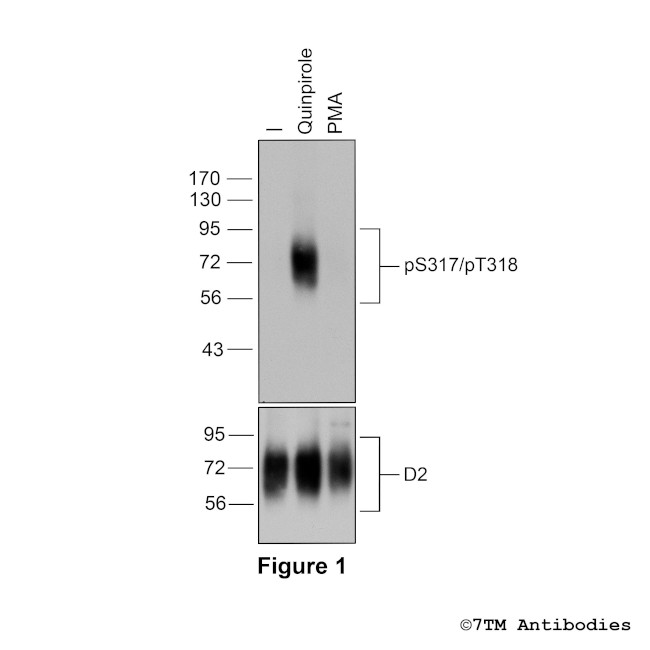 Phospho-Dopamine Receptor 2 (Ser317, Thr318) Antibody in Western Blot (WB)