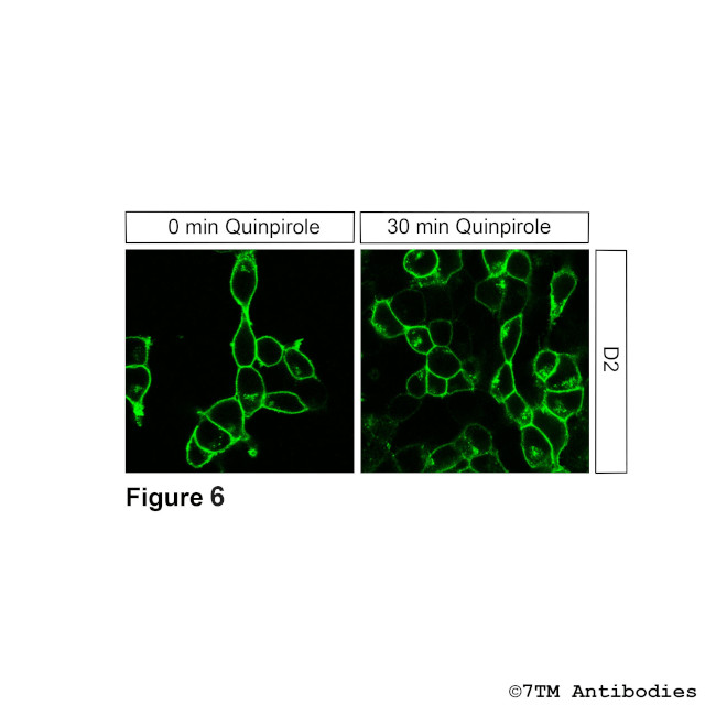 D2, Dopamine Receptor 2 Antibody in Immunocytochemistry (ICC/IF)