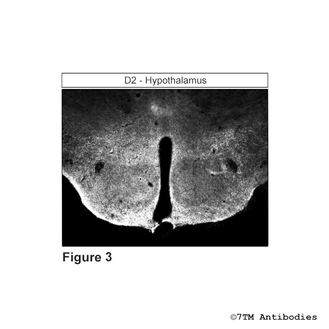 D2, Dopamine Receptor 2 Antibody in Immunohistochemistry (PFA fixed) (IHC (PFA))