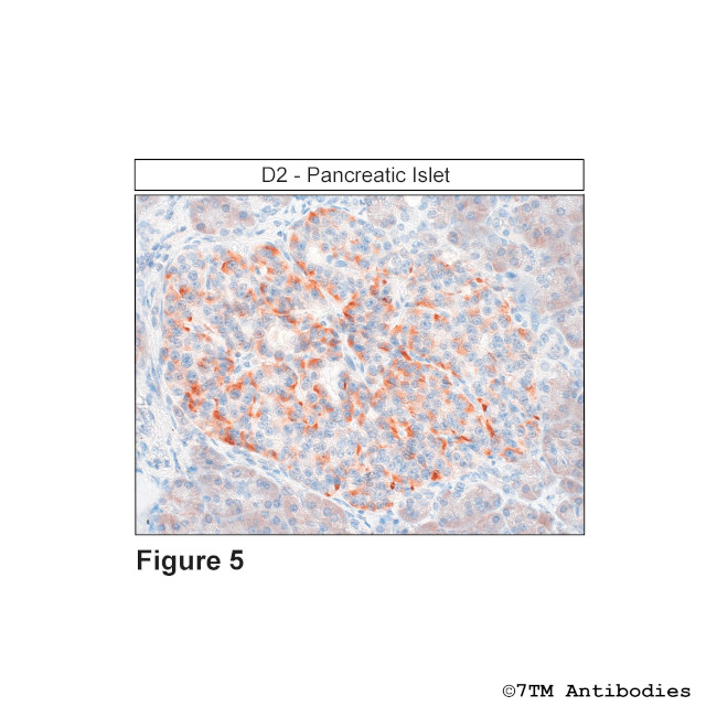 D2, Dopamine Receptor 2 Antibody in Immunohistochemistry (PFA fixed) (IHC (PFA))