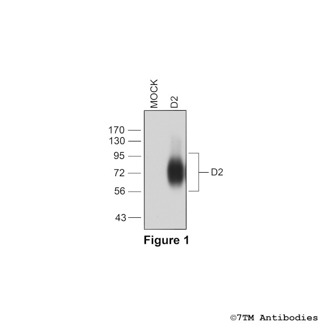 D2, Dopamine Receptor 2 Antibody in Western Blot (WB)