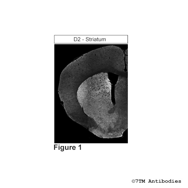 D2, Dopamine Receptor 2 Antibody in Immunohistochemistry (PFA fixed) (IHC (PFA))