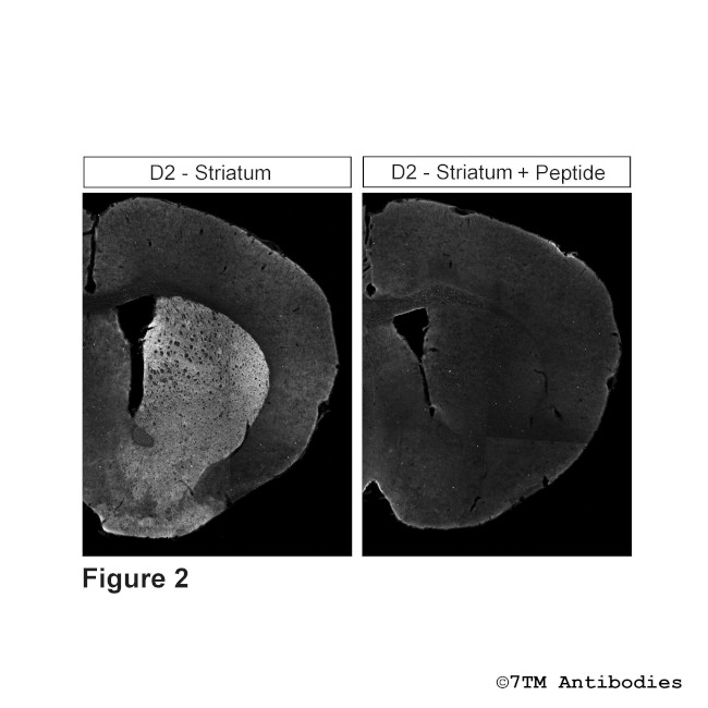 D2, Dopamine Receptor 2 Antibody in Immunohistochemistry (PFA fixed) (IHC (PFA))