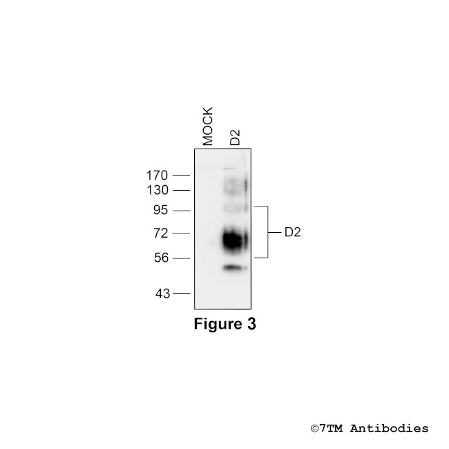 D2, Dopamine Receptor 2 Antibody in Western Blot (WB)