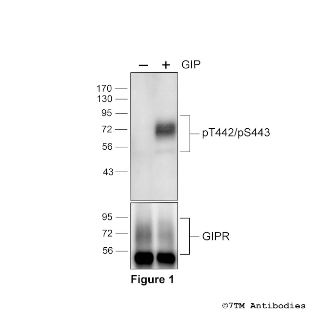 Phospho-Gastric Inhibitory Polypeptide Receptor (Thr442, Ser443) Antibody in Western Blot (WB)