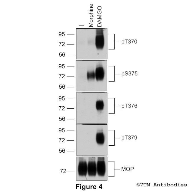 Phospho-mu-Opioid Receptor (Thr370) Antibody in Western Blot (WB)