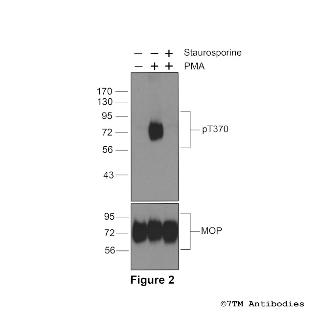 Phospho-mu-Opioid Receptor (Thr370) Antibody in Western Blot (WB)