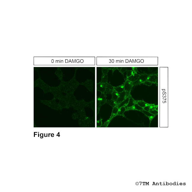 Phospho-mu-Opioid Receptor (Ser375) Antibody in Immunocytochemistry (ICC/IF)