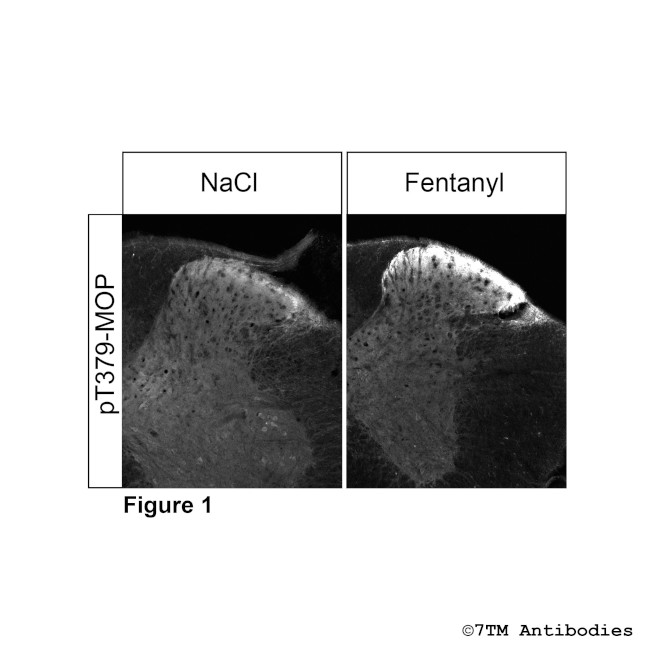 Phospho-mu-Opioid Receptor (Thr379) Antibody in Immunohistochemistry (PFA fixed) (IHC (PFA))