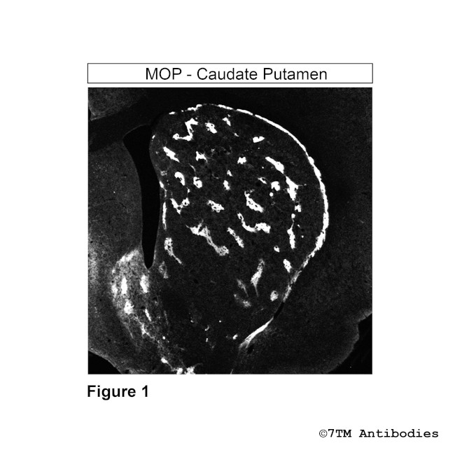 MOP, mu-Opioid Receptor Antibody in Immunohistochemistry (Paraffin) (IHC (P))