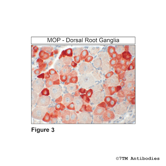 MOP, mu-Opioid Receptor Antibody in Immunohistochemistry (Paraffin) (IHC (P))