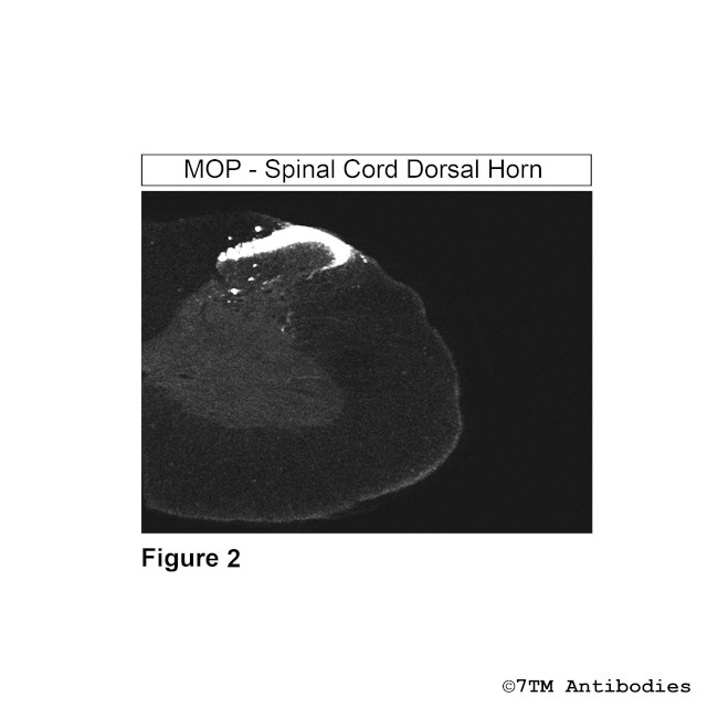 MOP, mu-Opioid Receptor Antibody in Immunohistochemistry (Paraffin) (IHC (P))