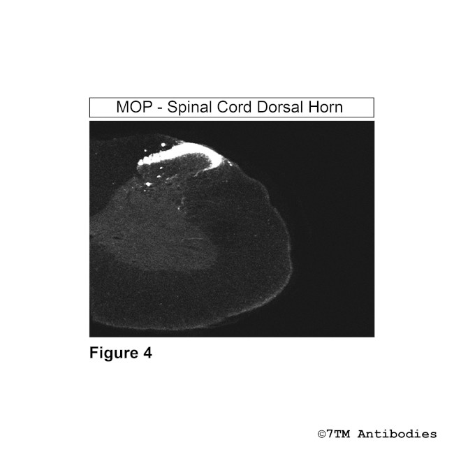 MOP, mu-Opioid Receptor Antibody in Immunohistochemistry (PFA fixed) (IHC (PFA))