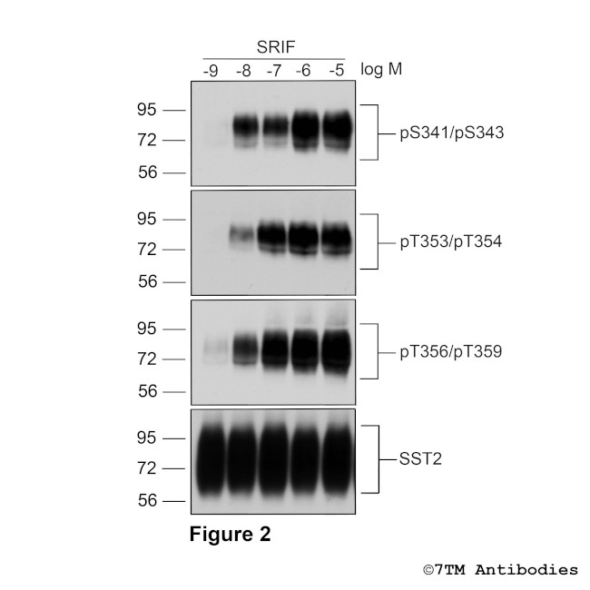 Phospho-Somatostatin Receptor 2 (Ser341, Ser343) Antibody in Western Blot (WB)