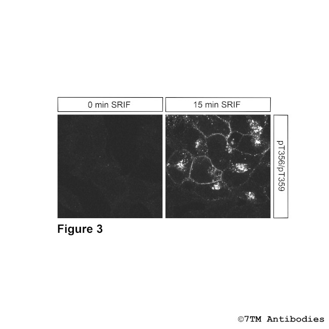 Phospho-Somatostatin Receptor 2 (Thr356, Thr359) Antibody in Immunocytochemistry (ICC/IF)