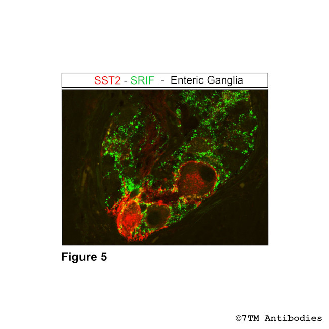 SST2, Somatostatin Receptor 2 Antibody in Immunocytochemistry (ICC/IF)