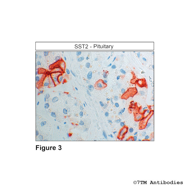 SST2, Somatostatin Receptor 2 Antibody in Immunohistochemistry (Paraffin) (IHC (P))